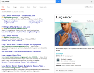 lung cancer search results